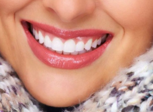 Косметическая стоматология - профилактика и восстановление зубов