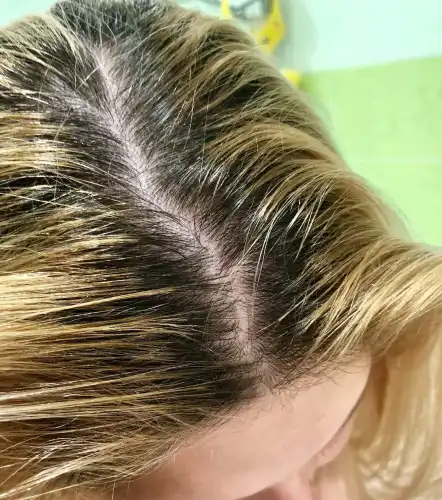 Двійко шкідливих і трійко корисних настанов для власниць жирного волосся.